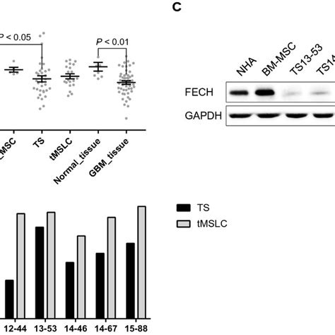 5 Ala Mediated Fluorescence In Gbm Evaluation Of 5 Ala Induced Ppix