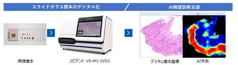 胃がんai病理診断支援ソフトウェア、連続症例における評価でauc096を達成 株式会社エビデントのプレスリリース