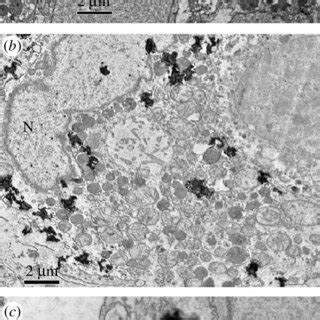 TEM Images Of The MCF 7 Cells A Before And 5 Hours Post Treatment