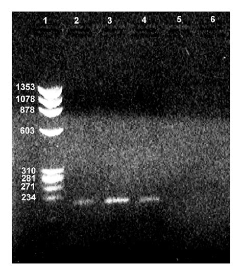 Agarose Gel Electrophoresis Of The Minch Pcr Products From Archived