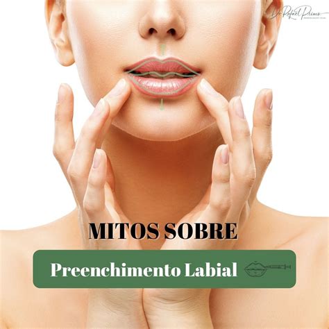 Mitos Sobre O Preenchimento Labial