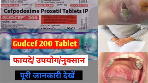 Gudcef Tablet Review In Hindi Uses Doses Sides Effects