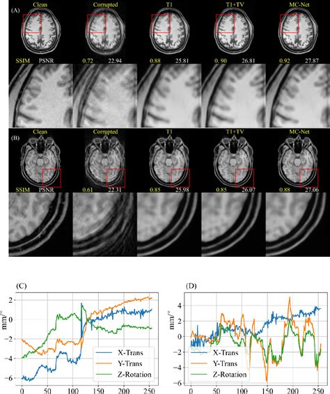 Figure From Motion Correction For Brain Mri Using Deep Learning And A