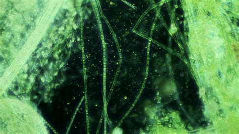 Water Algae Lab Sample 400x (HD). Microscopic Algae Seen At 400 Times ...