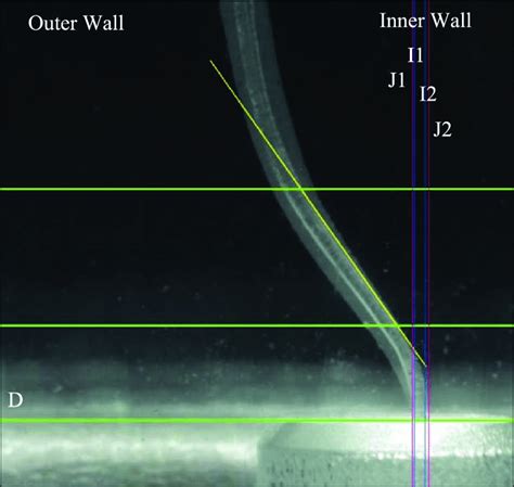 Measuring The Transportation On The Apical Point The I1 And I2 Lines