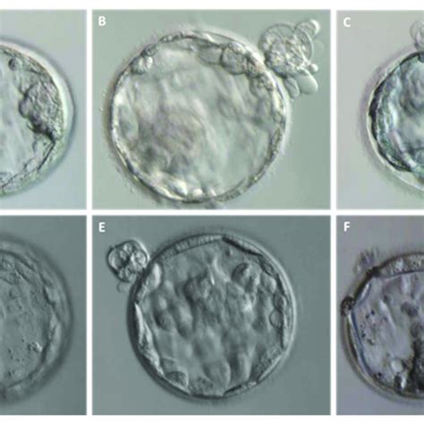 entire blastomeres  excluded  blastocyst formation