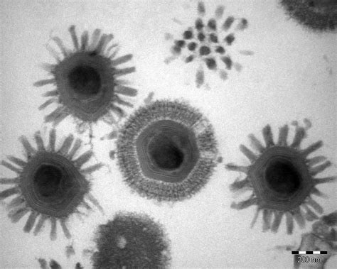 Giant Virus Origins Become A Little Clearer Shots Health News Npr