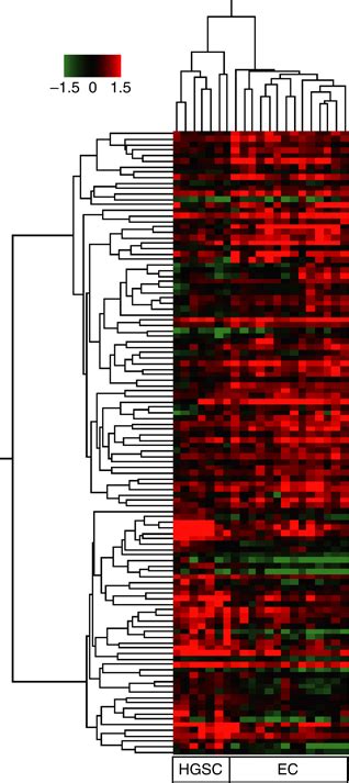 Differential Protein Expression Profiles Of Hgsc And Ec Samples