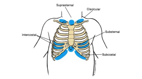 Pediatric Physical Assessment Flashcards Quizlet