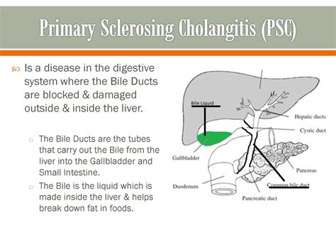 Primary Sclerosing Cholangitis Psc Ppt Download