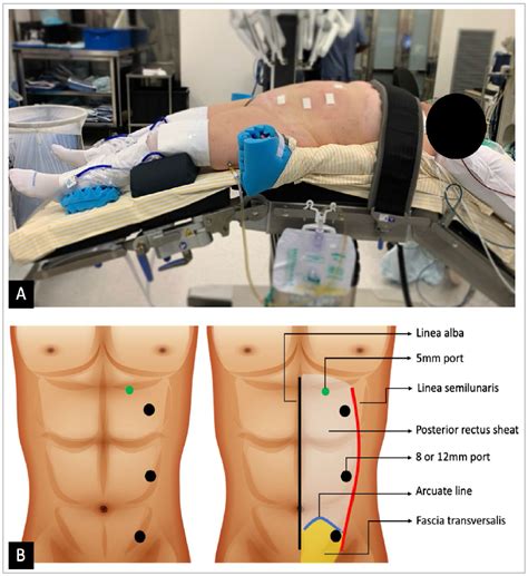 Scielo Brasil Standardization And Ten Essential Steps In The