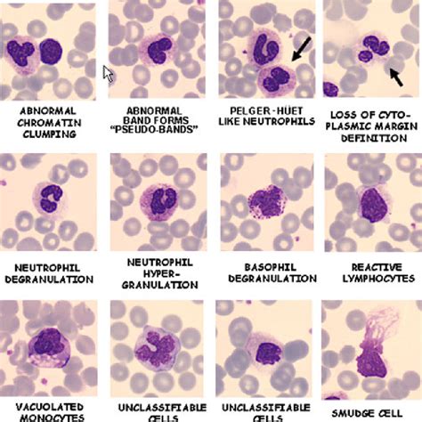 Blood Cell Morphology