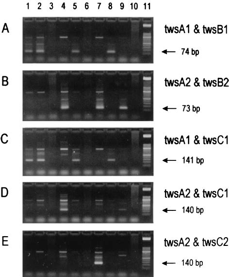 Representative Results Of Nested Pcr Assays For Direct De Tection Of