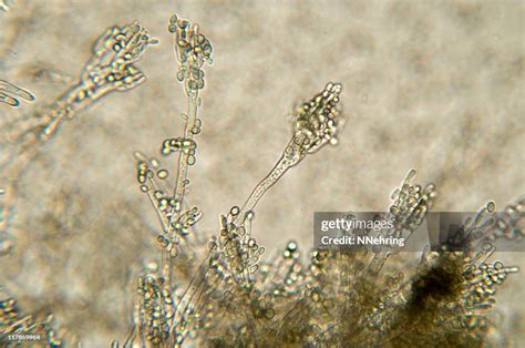 Penicillium Mold Micrograph High-Res Stock Photo - Getty Images