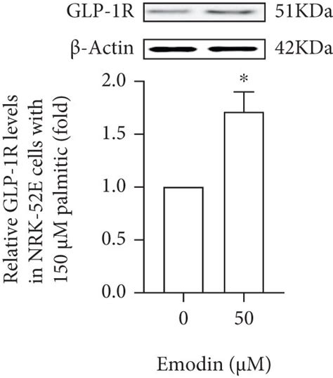 GLP 1R and PPAR γ in NRK 52E cells with palmitic acid a b shows