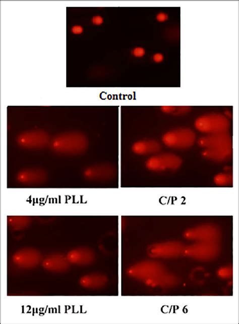 The Single Cell Gel Electrophoresis Comet Assay For Detection Of Dna