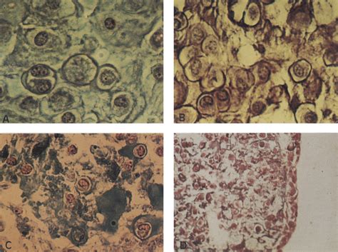 Sections Of Human Chondrocyte Aggregates Stained With Hematoxylin And