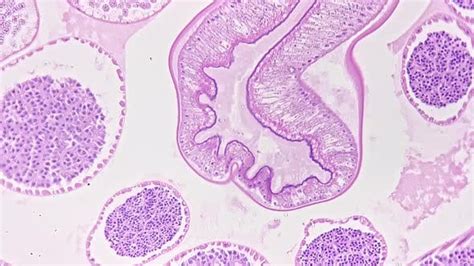 Cross Section Of Ascaris Magnified Under Microscope In 200 Times Filmed On Bright Field