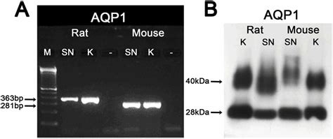 Differences In The Localization Of AQP1 And Expression Patterns Of AQP