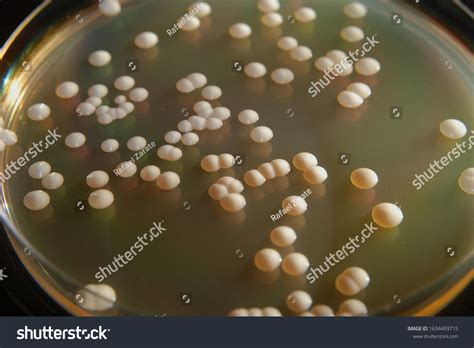 Saccharomyces Cerevisiae Stock Photos Images Photography