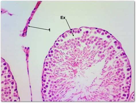 Transverse Sections In Rat Testis From The Four Weeks Alcl 3 Download Scientific Diagram