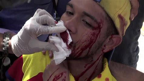 Venezuela El Violinista De Las Protestas Resulta Herido En El Rostro