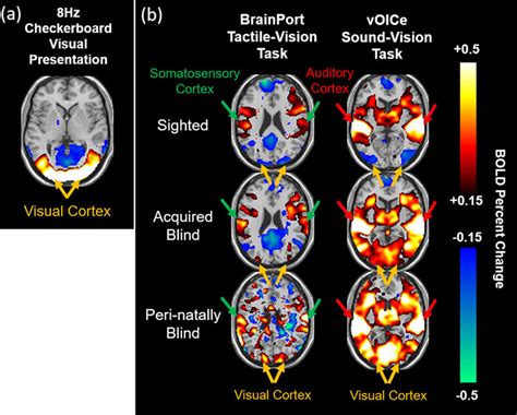 BOLD Functional MRI Of Multimodal Sensory Substitution Task Based BOLD