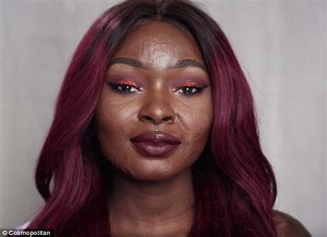 Brave Girl With Burn Scars On Her Face Does Incredible Makeup Tutorials Women Daily Magazine