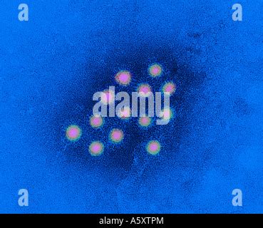 This Colorized Negative Stained Transmission Electron Micrograph Tem