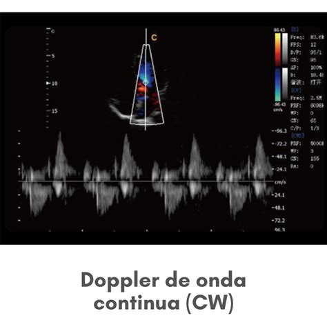 Ec Grafo Chison Eco Con Sonda Lineal Mhz Ec Grafos Para