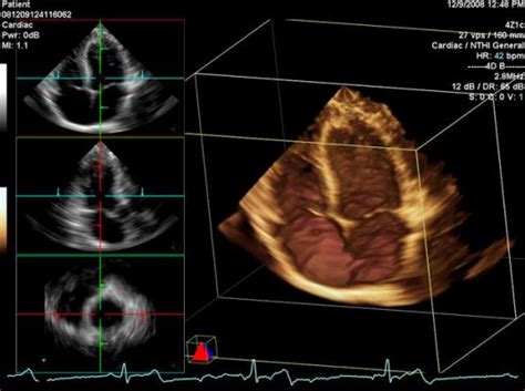 Heart Test Echo And Ecg In Aligarh Mittal Diagnostic And Research Center Mittal Diagnostic