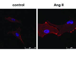 CircNfix Protected Cardiomyocytes Against Ang II In Vitro A