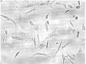 Adult human therapeutic cloning of embryonic stem cells by SCNT - The Niche