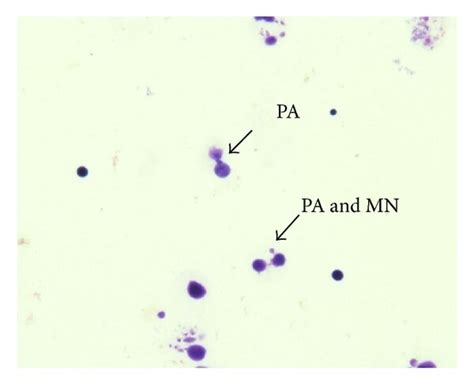 A Photomicroscopy Of Binucleated Lymphocyte Without Micronucleus Download Scientific Diagram