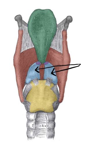 Airway Anatomy Airway Management Flashcards Quizlet