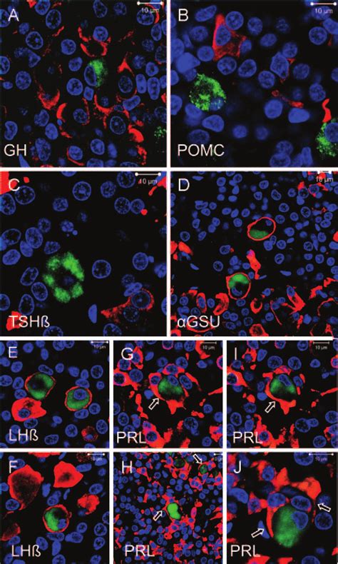 Confocal Microscopic Photomicrographs Of Double Immunofluorescent