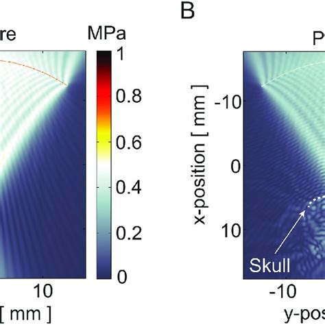 Acoustic Pressure Field Simulations Acoustic Pressure Fields Generated