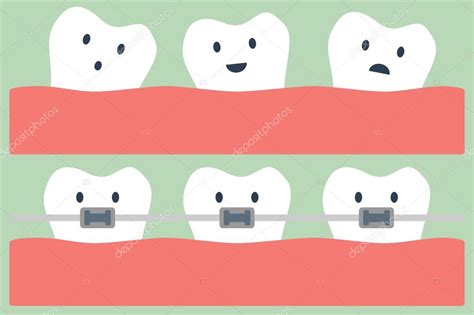 Dibujos Animados Dientes Ortodoncia — Archivo Imágenes Vectoriales