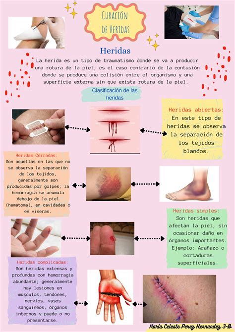 Curacion De Heridas Espero Te Ayude Heridas Complicadas Son