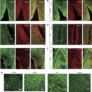 Embryonic Rat Brain Expresses P X R Photomicrographs Of The Coronal