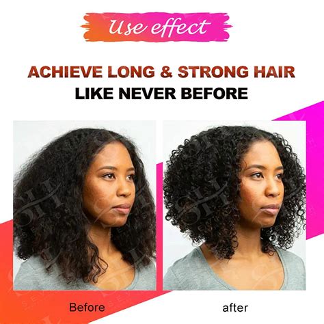 Fast Hair Growth Essence Natural Herbal Health Treatment Hair Loss