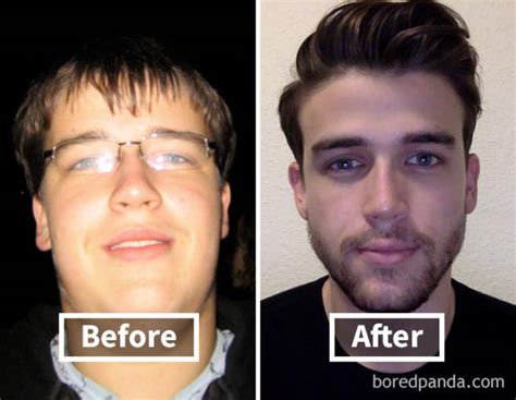 Heres How Weight Loss Can Change Your Face 40 Pics