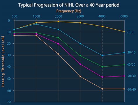 What Is Noise Induced Hearing Loss Nihl Bend Or Redmond Or