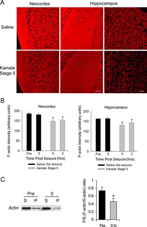 Kainate Seizures Cause Acute Depolymerization Of F Actin A