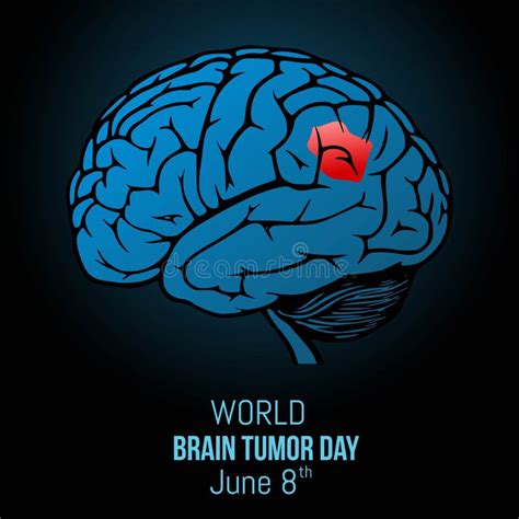 World Brain Tumor Day Vector Illustration Stock Vector - Illustration ...