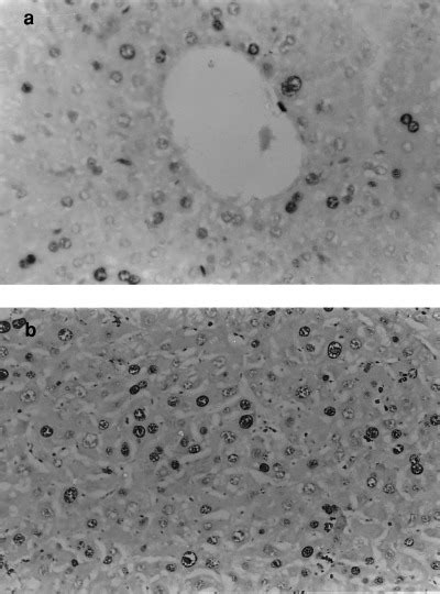 Immunohistochemical Detection Of Proliferating Cell Nuclear Antigen Download Scientific Diagram