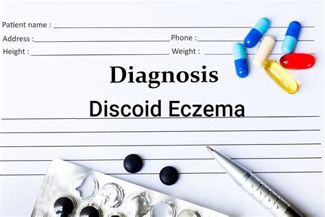 Causes, Symptoms, and Treatments of Discoid Eczema - Facty Health