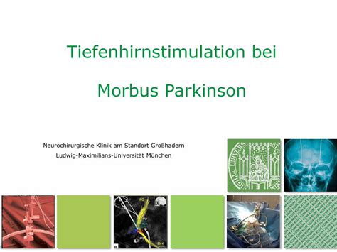 Pdf Tiefenhirnstimulation Bei Morbus Parkinson Dysarthrie