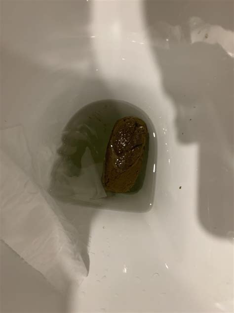 Is this colon cancer thin stool? : r/poop