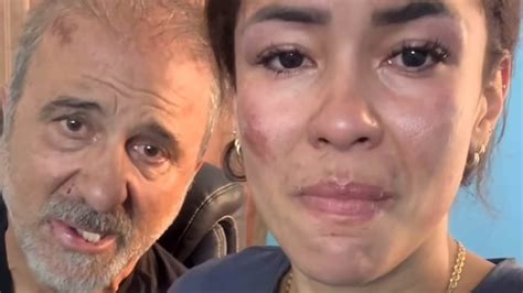 Brazilian Influencer Shares Harrowing Footage After She Was Beaten And